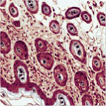 Histopathology image